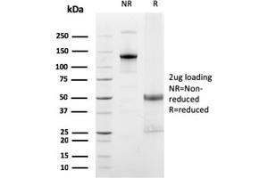 SDS-PAGE Analysis Purified FCGRT Mouse Monoclonal Antibody (FCGRT/2932). (FcRn antibody  (AA 24-215))