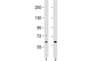 Western blot testing of human 1) Jurkat and 2) human fetal kidney lysate with EPHX2 antibody at 1:2000. (EPHX2 antibody  (AA 64-94))