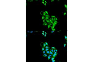 Immunofluorescence analysis of U2OS cells using JADE1 antibody (ABIN5973751).