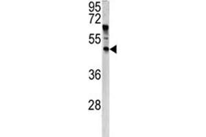 Western blot analysis of ANGPTL7 antibody and HeLa lysate. (ANGPTL7 antibody  (AA 74-104))