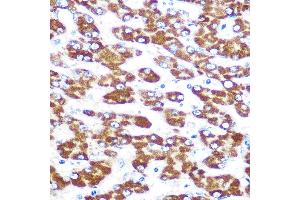 Immunohistochemistry of paraffin-embedded human liver using IDO1 Rabbit mAb (ABIN7267863) at dilution of 1:100 (40x lens). (IDO1 antibody)