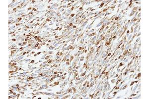 IHC-P Image Immunohistochemical analysis of paraffin-embedded C2C12 xenograft, using CoCoA, antibody at 1:100 dilution. (CALCOCO1 antibody)