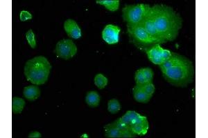 Immunofluorescence staining of MCF-7 with ABIN7146416 at 1:50, counter-stained with DAPI. (PDE1B antibody  (AA 1-277))