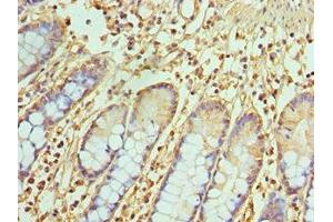 Immunohistochemistry of paraffin-embedded human small intestine tissue using ABIN7172071 at dilution of 1:100 (TREX1 antibody  (AA 1-270))