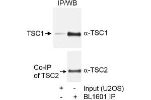 Immunoprecipitation (IP) image for anti-Tuberous Sclerosis 1 (TSC1) (C-Term) antibody (ABIN7449615) (TSC1 antibody  (C-Term))