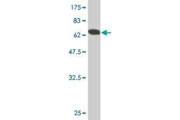 HCV E2 antibody  (AA 412-661)