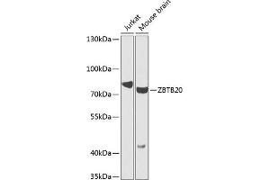 Western blot analysis of extracts of various cell lines, using ZBTB20 antibody (ABIN6130809, ABIN6150372, ABIN6150373 and ABIN6223978) at 1:1000 dilution. (ZBTB20 antibody  (AA 100-400))