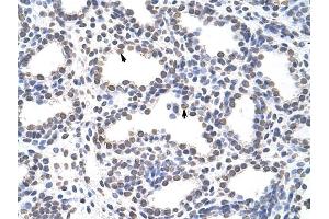 CARS antibody was used for immunohistochemistry at a concentration of 4-8 ug/ml to stain Alveolar cells (arrows) in Human Lung. (CARS antibody  (C-Term))