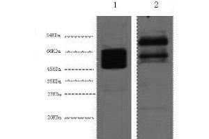 Western Blot analysis of 1) Hela, 2) Mouse brain using CK-8 Monoclonal Antibody at dilution of 1:4000. (KRT8 antibody)