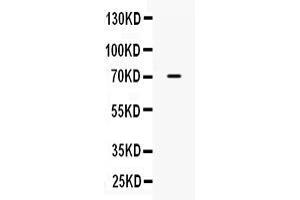 Western blot analysis of ALPP expression in human placenta extract ( Lane 1). (PLAP antibody  (C-Term))