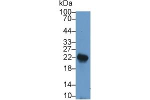 Detection of LIF in Rat Spleen lysate using Polyclonal Antibody to Leukemia Inhibitory Factor (LIF) (LIF antibody  (AA 2-201))
