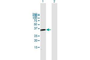 Western Blot analysis of C2 expression in transfected 293T cell line by C2 MaxPab polyclonal antibody. (Complement C2 antibody  (AA 20-328))