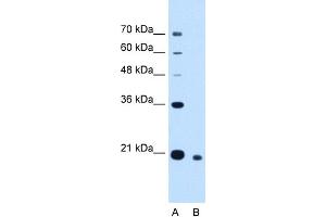 WB Suggested Anti-CDCA4 Antibody Titration:  2. (CDCA4 antibody  (N-Term))
