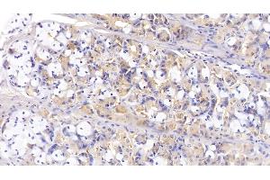 Detection of IL13 in Porcine Stomach Tissue using Polyclonal Antibody to Interleukin 13 (IL13) (IL-13 antibody  (AA 25-131))