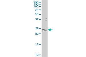 GSTZ1 MaxPab rabbit polyclonal antibody. (GSTZ1 antibody  (AA 1-216))