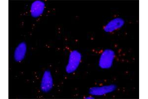 Proximity Ligation Analysis of protein-protein interactions between NFKBIB and FBXW11. (NFKBIB antibody  (AA 1-356))