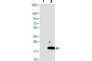Western blot analysis of Lane 1: Negative control (vector only transfected HEK293T lysate). (C2ORF76 antibody)
