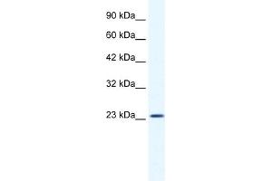 WB Suggested Anti-KCTD11 Antibody Titration:  1. (KCTD11 antibody  (N-Term))