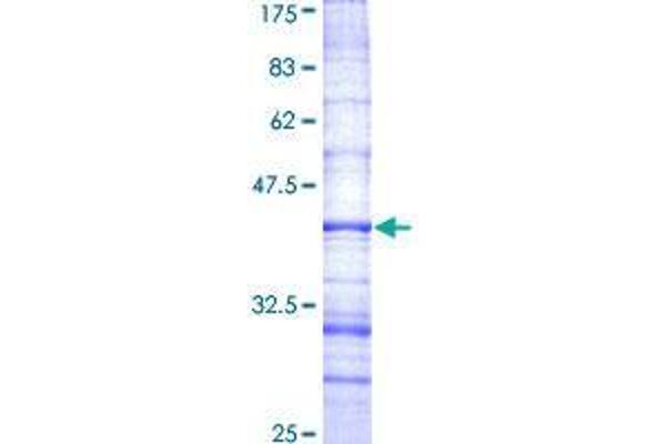 STRADB Protein (AA 319-418) (GST tag)