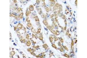 Immunohistochemistry of paraffin-embedded Human stomach using ANTXR2 Polyclonal Antibody at dilution of 1:100 (40x lens).
