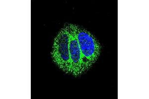 Confocal immunofluorescent analysis of RARA Antibody (C-term) (ABIN657770 and ABIN2846746) with MCF-7 cell followed by Alexa Fluor® 488-conjugated goat anti-rabbit lgG (green). (Retinoic Acid Receptor alpha antibody  (C-Term))