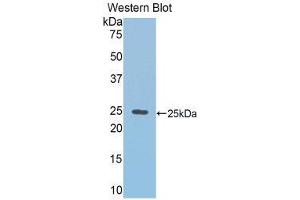 Western Blotting (WB) image for anti-RalA Binding Protein 1 (RALBP1) (AA 192-380) antibody (ABIN1860399)