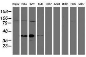 Image no. 1 for anti-Spastic Paraplegia 7 (SPG7) (AA 300-573) antibody (ABIN1491371) (SPG7 antibody  (AA 300-573))