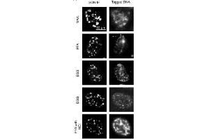 Images comparing the SON (a marker for nuclear speckles) immunofluorescence (IF) images (left panels) in different fixation conditions (MAA, methanol/acetic acid, 1% PFA; EGS, ethylene glycol bis(succinimidyl succinate); DSG, disuccinimidyl glutarate, 1% PFA followed by 0. (SON antibody  (N-Term))
