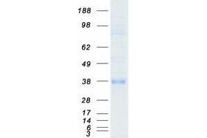 Western Blotting (WB) image for FOS-Like Antigen 1 (FOSL1) protein (Myc-DYKDDDDK Tag) (ABIN2721317)