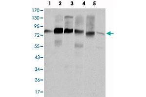 Western blot analysis using CTTN monoclonal antibody, clone 4C6  against HeLa (1) , A-431 (2) , MCF-7 (3) , SR-BR-3 (4) , HepG2 (5) and NIH/3T3 (6) cell lysate. (Cortactin antibody)