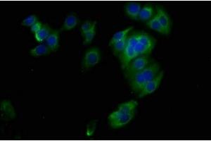 Immunofluorescence staining of HepG2 cells with ABIN7171189 at 1:400, counter-stained with DAPI. (Syndecan 1 antibody  (AA 23-254))