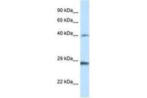 Image no. 1 for anti-Homeobox B9 (HOXB9) (AA 20-69) antibody (ABIN6747415) (HOXB9 antibody  (AA 20-69))