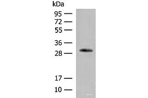 Western blot analysis of Human left thymus tissue lysate using VDAC3 Polyclonal Antibody at dilution of 1:200 (VDAC3 antibody)