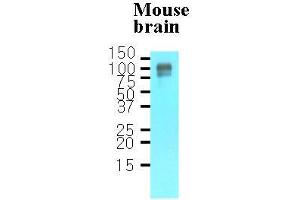 Tissue lysates of mouse brain(30 ug) were resolved by SDS-PAGE, transferred to nitrocellulose membrane and probed with anti-human APP (1:1000). (APP antibody  (AA 18-289))