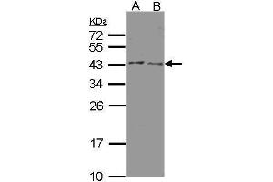 WB Image Sample(30 μg of whole cell lysate) A:HeLa S3 , B:MOLT4, 12% SDS PAGE antibody diluted at 1:500 (HSD3B2 antibody)
