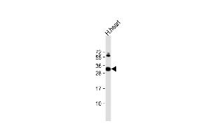 Anti-CLIC2 Antibody (Center) at 1:2000 dilution + human heart lysate Lysates/proteins at 20 μg per lane. (CLIC2 antibody  (AA 105-137))