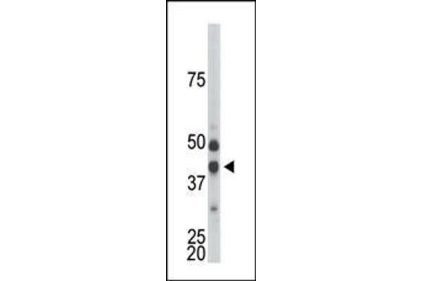 CDKL1 antibody  (C-Term)