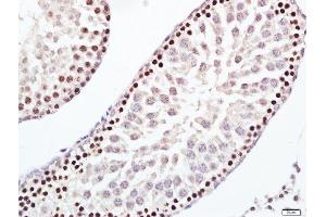 Paraformaldehyde-fixed, paraffin embedded rat testis tissue, Antigen retrieval by boiling in sodium citrate buffer(pH6) for 15min, Block endogenous peroxidase by 3% hydrogen peroxide for 30 minutes, Blocking buffer (normal goat serum) at 37°C for 20min, Antibody incubation with Rabbit Anti-ERCC1 Polyclonal Antibody, Unconjugated  at 1:200 overnight at 4°C, followed by a conjugated secondary and DAB staining (ERCC1 antibody  (AA 151-250))