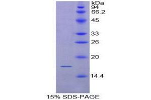 SDS-PAGE (SDS) image for CD72 Molecule (CD72) (AA 126-237) protein (His tag) (ABIN1879008)