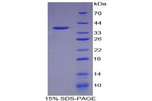 SDS-PAGE (SDS) image for Lectin, Galactoside-Binding, Soluble, 8 (LGALS8) (AA 1-317) protein (His tag) (ABIN1079632)