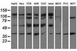 Image no. 2 for anti-CD5 (CD5) antibody (ABIN1497337) (CD5 antibody)