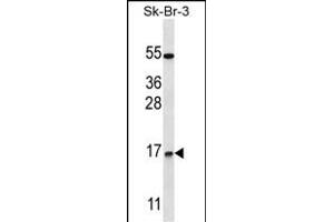 NRARP Antibody (Center) (ABIN657561 and ABIN2846568) western blot analysis in SK-BR-3 cell line lysates (35 μg/lane). (NRARP antibody  (AA 56-83))