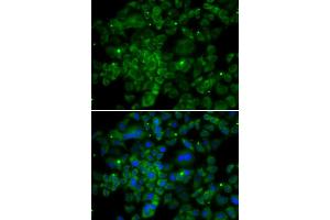 Immunofluorescence analysis of MCF-7 cells using CCL2 antibody (ABIN5974379). (CCL2 antibody)