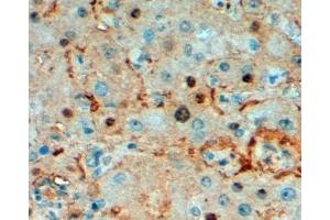 ABIN185349 (2µg/ml) staining of paraffin embedded Human Liver. (TPI1 antibody  (C-Term))