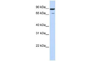 HIPK4 antibody used at 1 ug/ml to detect target protein. (HIPK4 antibody  (Middle Region))