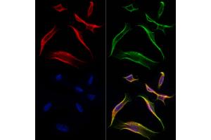 ABIN6261376 and ABIN6277015 staining Hela cells by IF/ICC.
