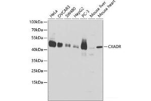 Western blot analysis of extracts of various cell lines using CXADR Polyclonal Antibody at dilution of 1:1000. (Coxsackie Adenovirus Receptor antibody)