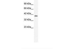 CATSPER2 Antikörper  (AA 31-80)