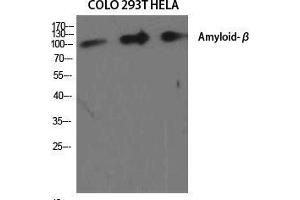 Western Blot (WB) analysis of specific cells using Amyloid-beta Polyclonal Antibody. (beta Amyloid antibody  (Ser15))