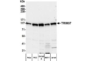 Western Blotting (WB) image for anti-Tripartite Motif Containing 37 (TRIM37) (AA 914-964) antibody (ABIN7539899)